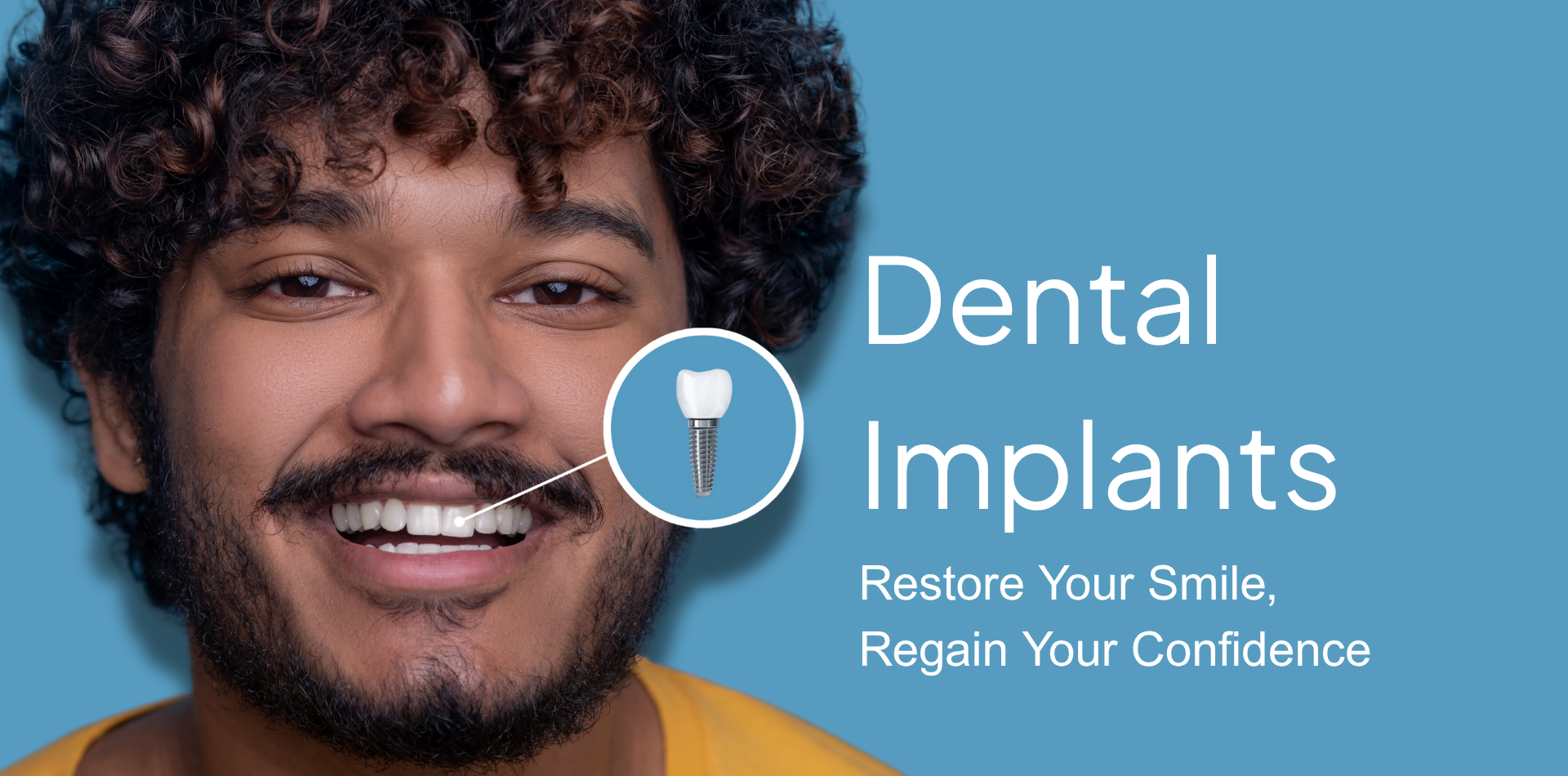 Dental Implants