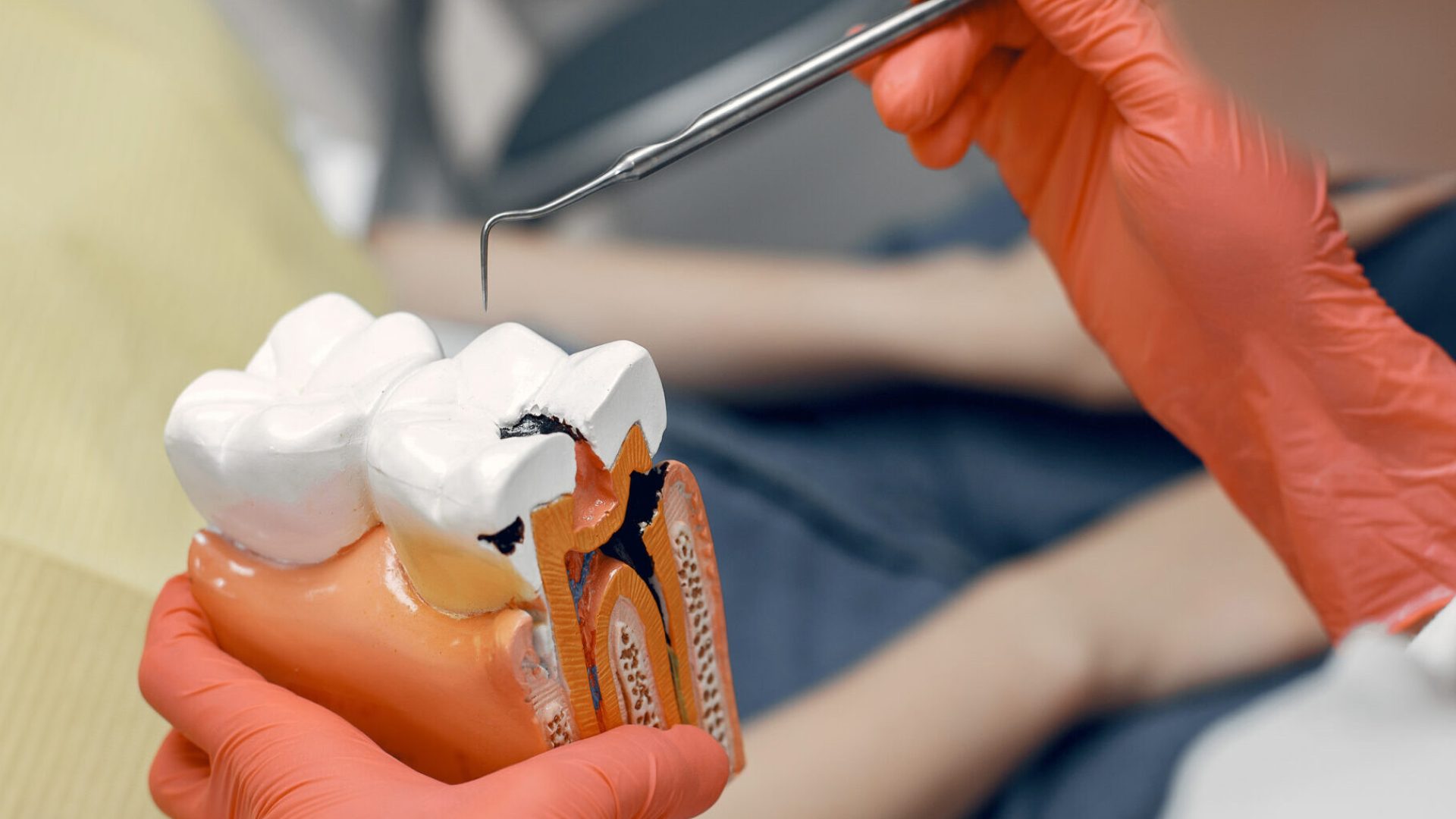 Model of a tooth at the dentist.Doctor shows the patient a tooth.Reception in the dentist's office